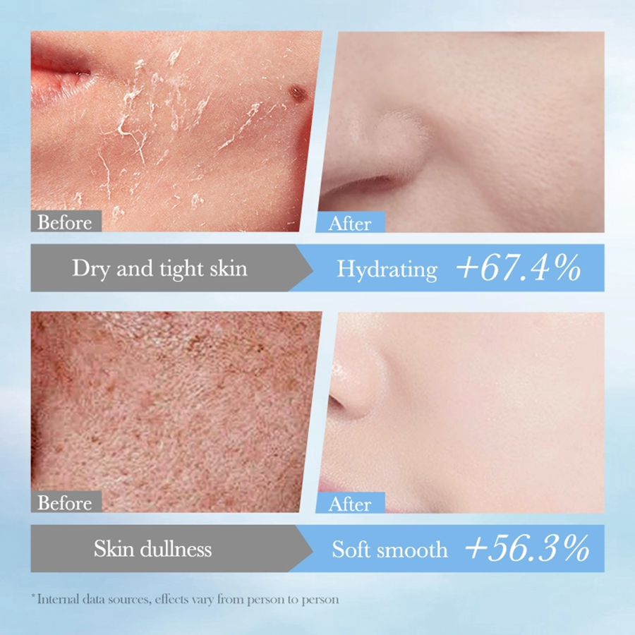 Bioagua Squalane + Hyaluronic Acid Hydrating Moisturizing Facial Mask 25ml