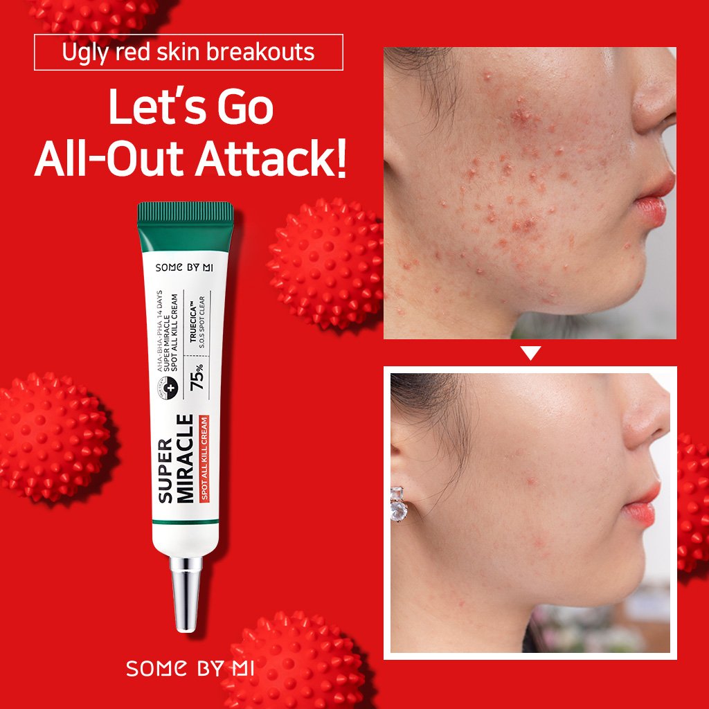 Some By Mi Aha·Bha·Pha 14 Days Super Miracle Spot All Kill Cream 30ml BD