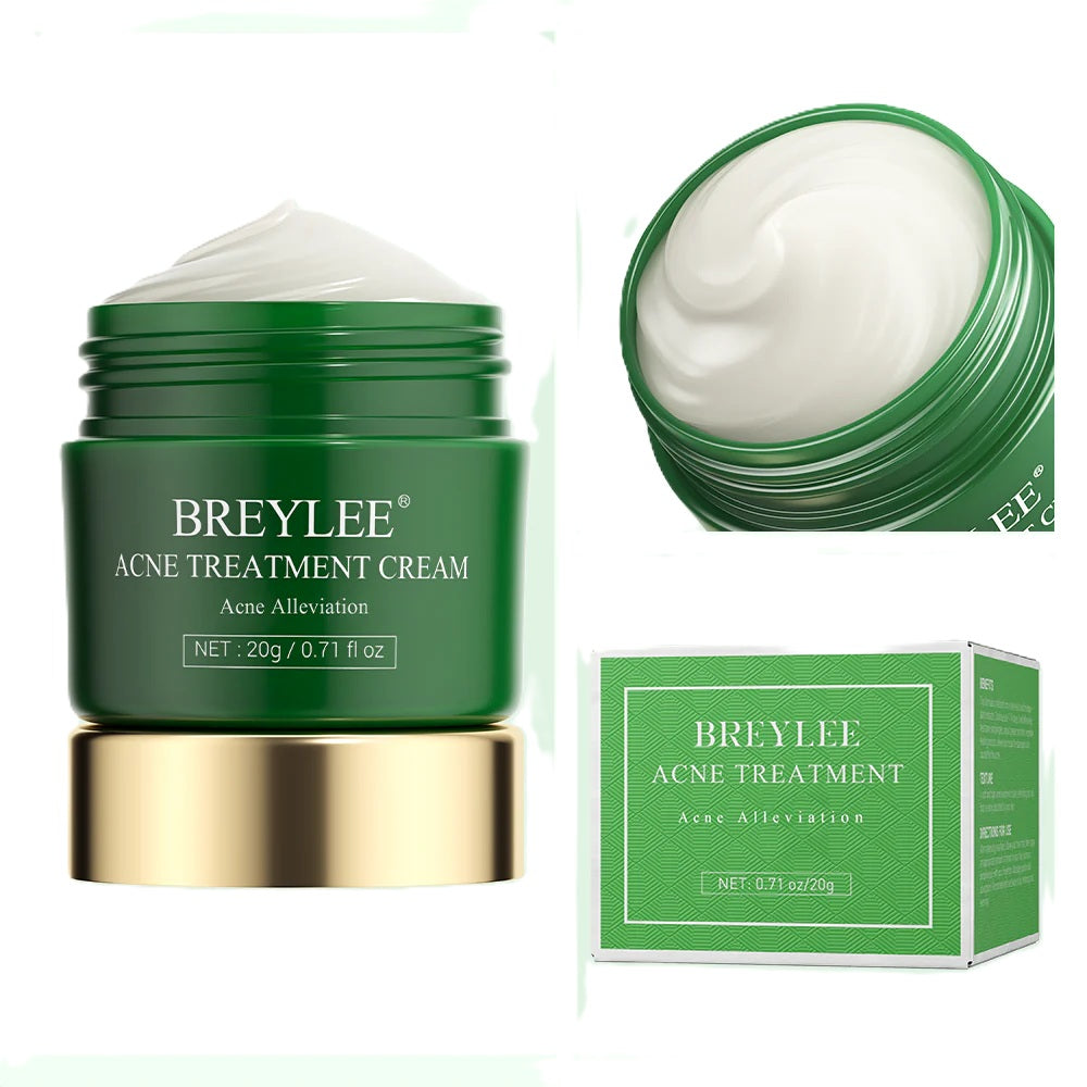 Breylee Acne Treatment Cream jar, open container showing white cream texture, and product packaging box on light green background