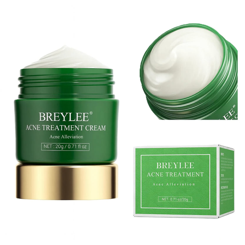 Breylee Acne Treatment Cream jar, open container showing white cream texture, and product packaging box on light green background