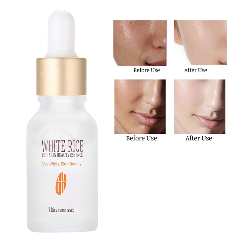 Rorec White Rice Whitening Essence Face Serum 15ml BD