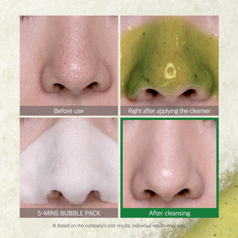 Some By Mi Bye Bye Blackhead 120g BD